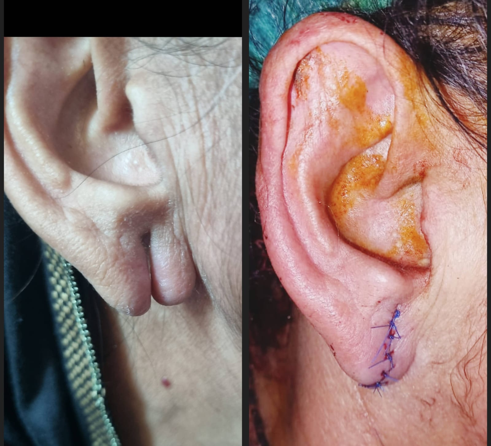 Before & After 51